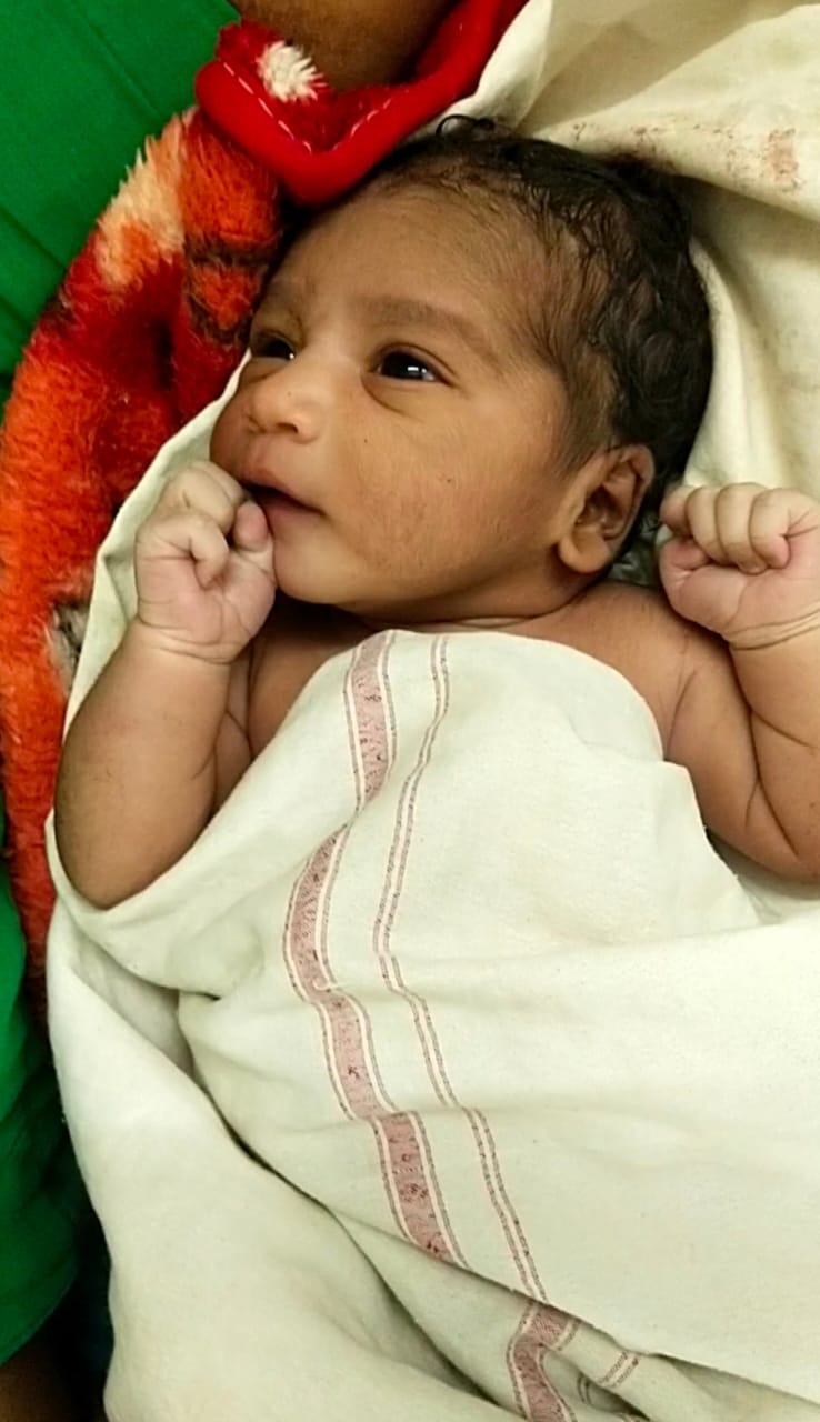 ಕುಷ್ಟಗಿ: ಎಳೆಗೂಸುವಿನ ಮೇಲೆ ಮಂಗ ದಾಳಿ, ತೀವ್ರ ಗಾಯ 